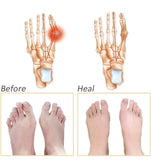 6057 Silicone Gel Half Toe Sleeve Pads (1Pair)