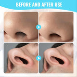 13752 Nose Hair Removal Trimmer Nose Hair Remover Razor Kit Blade (3 Pcs Set)