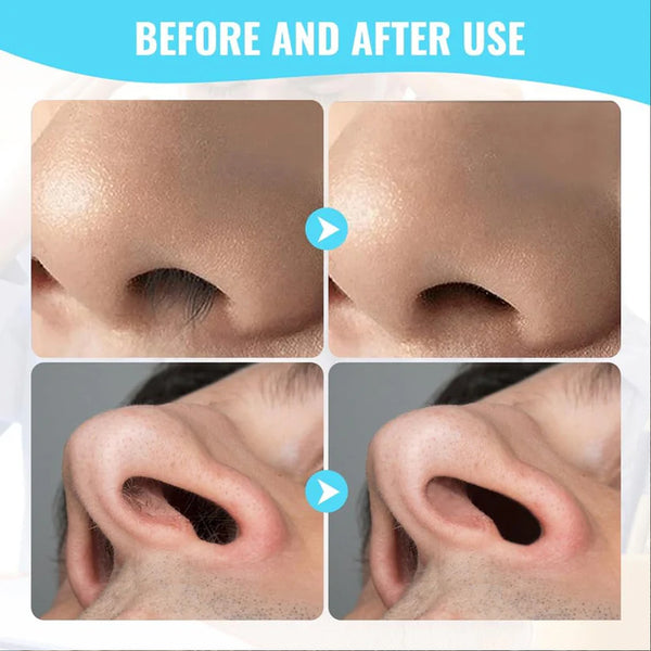 13752 Nose Hair Removal Trimmer Nose Hair Remover Razor Kit Blade (3 Pcs Set)