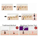 0351 -4 In 1 Blackhead Whitehead Extractor Remover Device Acne Pimple Pore Cleaner (Vacuum Suction Tool)