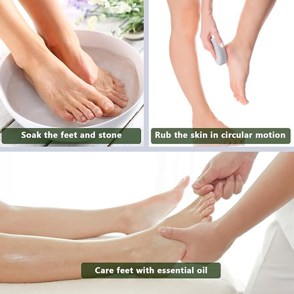 AM7631 Natural Oval Pumice Stone Exfoliator for Foot Care and Dead Skin Callus Removal